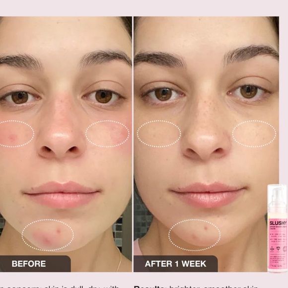 Slushy - INNBEAUTY Project
Serum Moisturizer 2N1
1.7 oz BRAND NEW - Picture 3 of 16